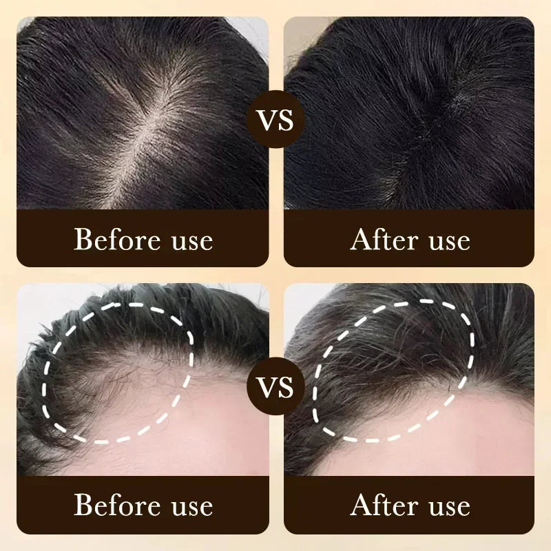 Biotin fast Hair Growth oil Products Care Scalp Massage Treatments Anti Hair Loss Effective Grow Thicker Hair serum for men